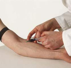 Blood Tests
