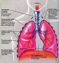 Pericardial Mesothelioma