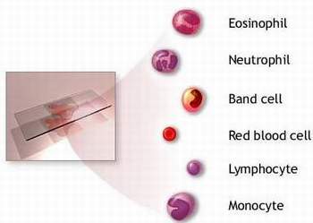 Complete Blood Count