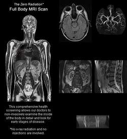 Full Body MRI Scan