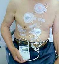 holter monitor