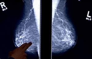 Mammography X-Ray