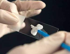 Smear Test