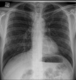 xray